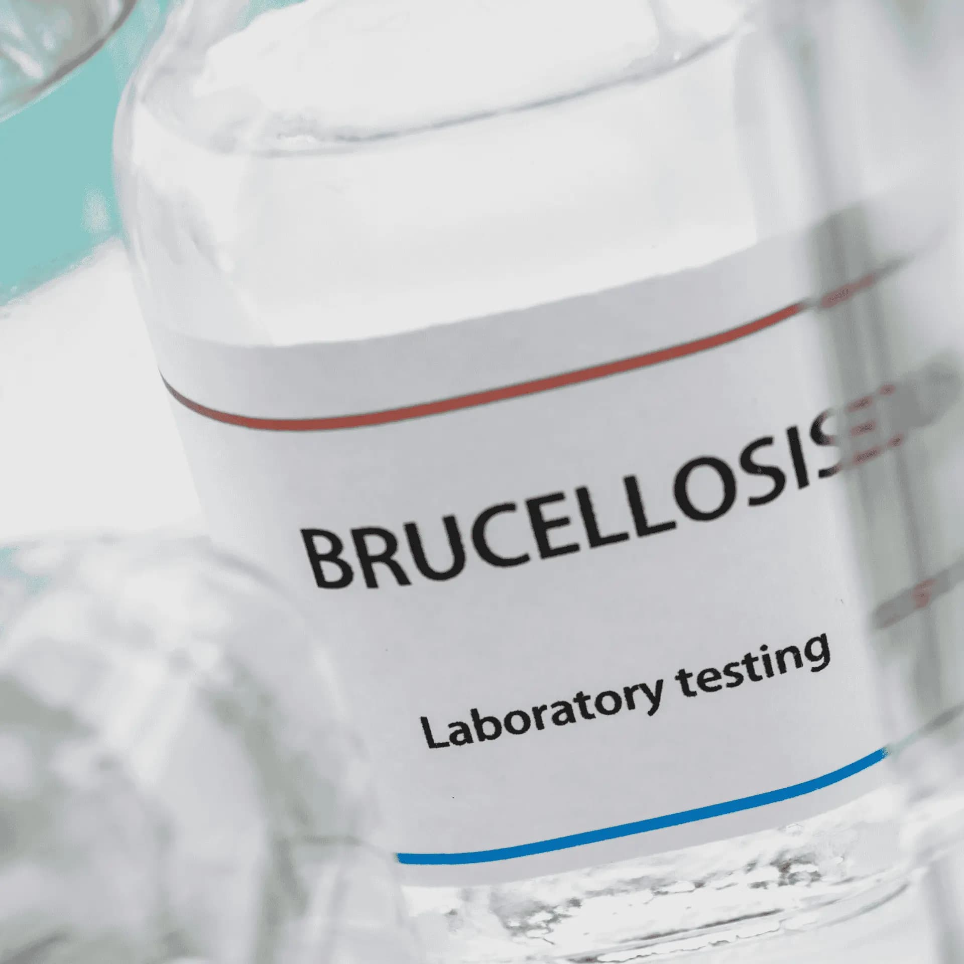 اختبار البروسيلا (ELISA)