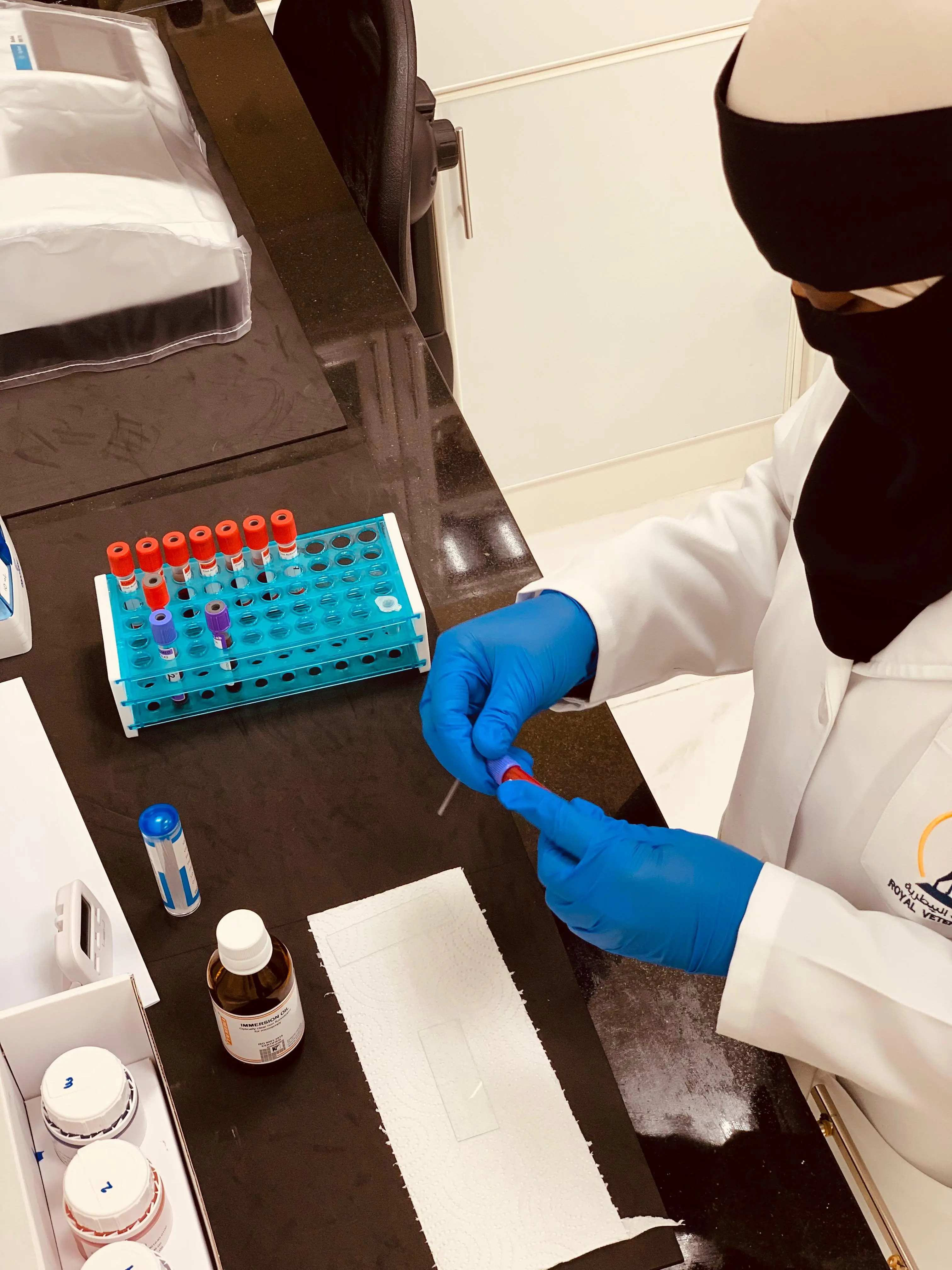 علم الدم - CBC