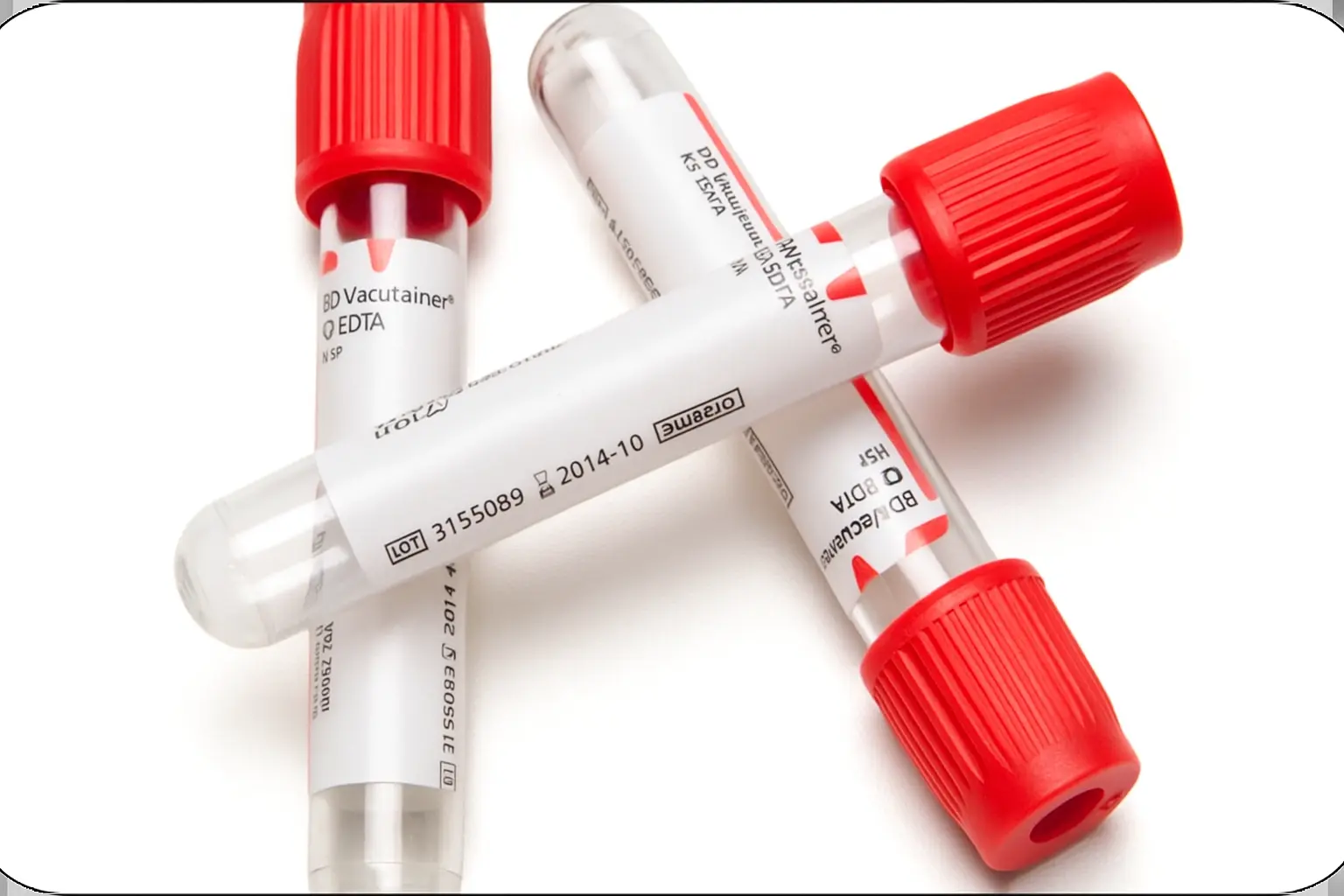 Brucellosis Indirect ELISA test
