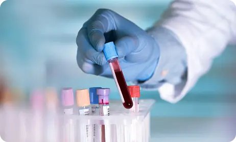 Rose Bengal Brucellosis test